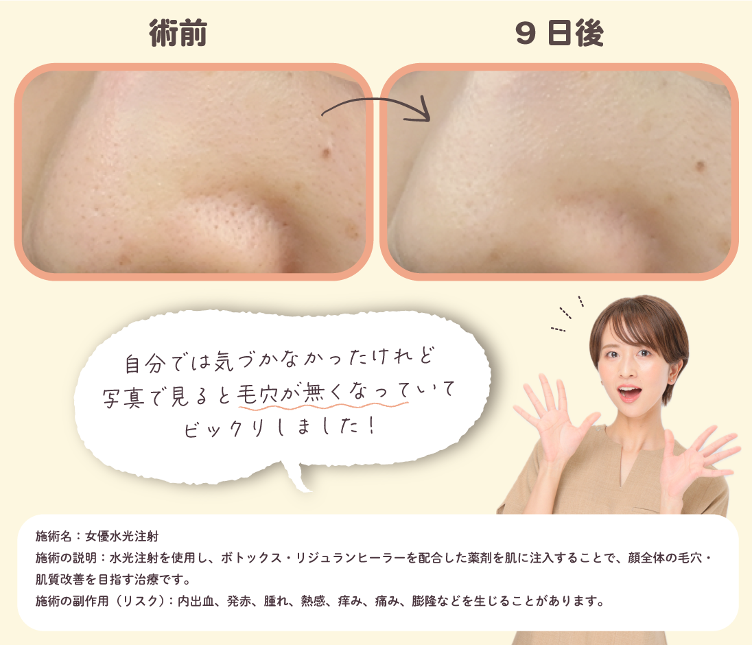岐阜院の皮膚科担当医【近藤杏奈医師】が女優水光注射を実体験！